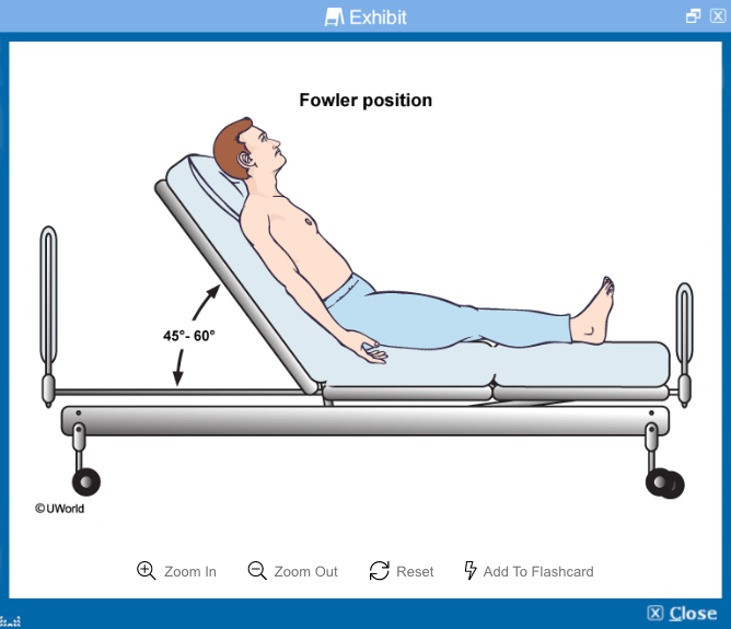 NCLEX RN® Sample Question - Updated 2021 | UWorld Nursing