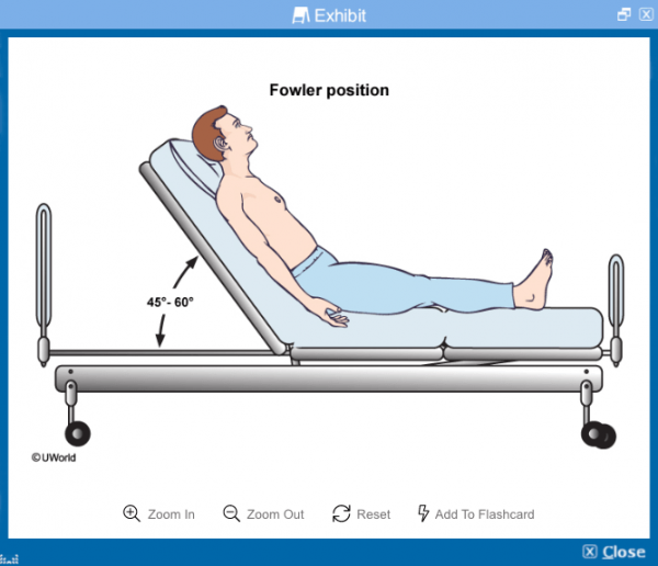 NCLEX RN® Sample Question - Updated 2021 | UWorld Nursing