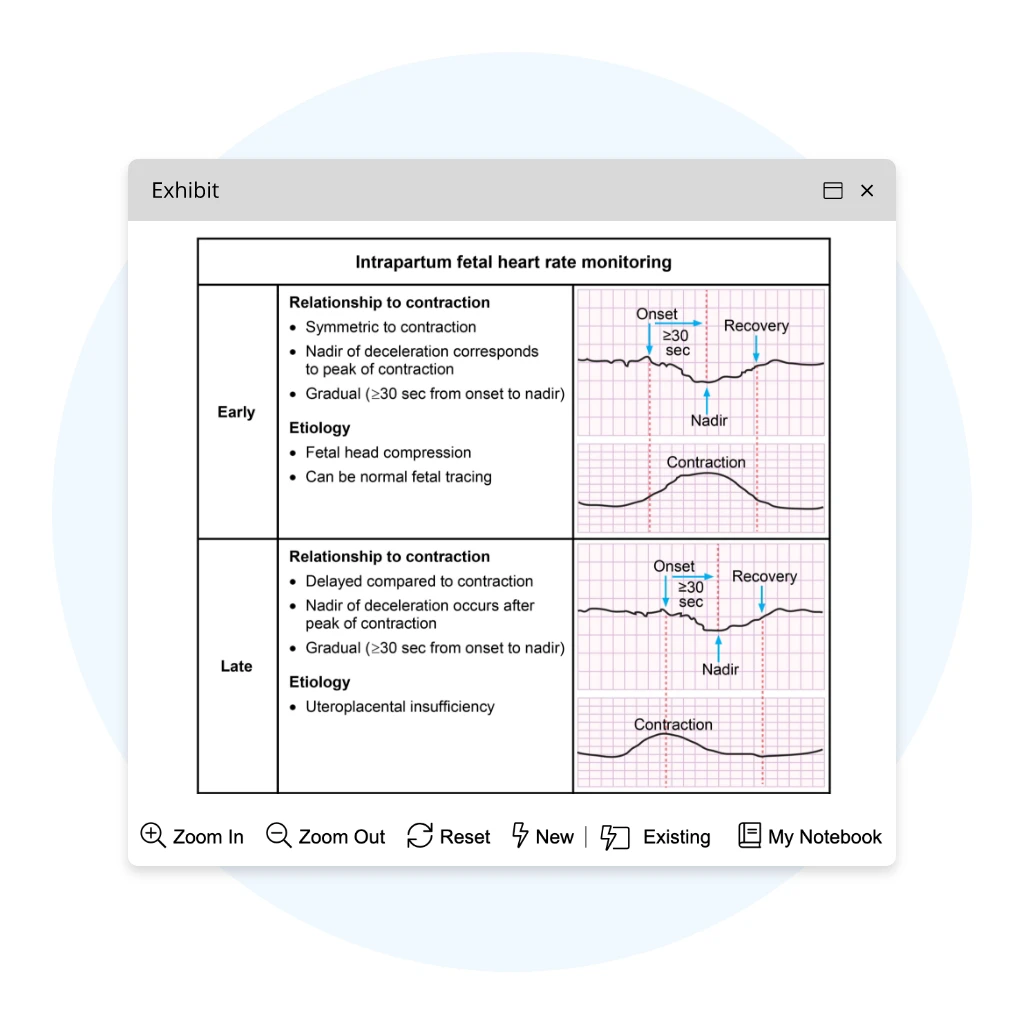 Screenshot of high-impact visuals from a detailed rationale in UWorld’s NCLEX-RN QBank.