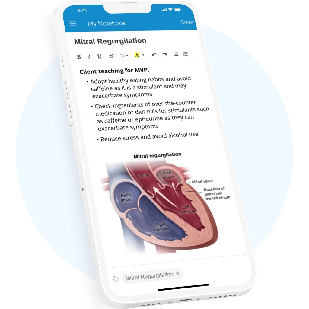 Mobile phone featuring practice questions in the UWorld Nursing app.