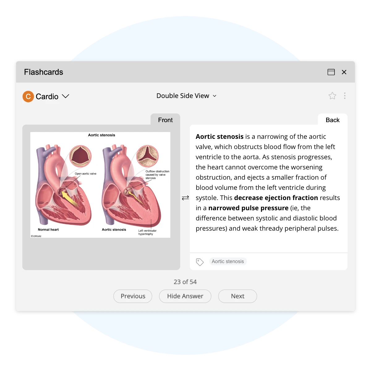 Image of a flashcard from the Self-Study section of UWorld’s Learning Platform for Nursing.