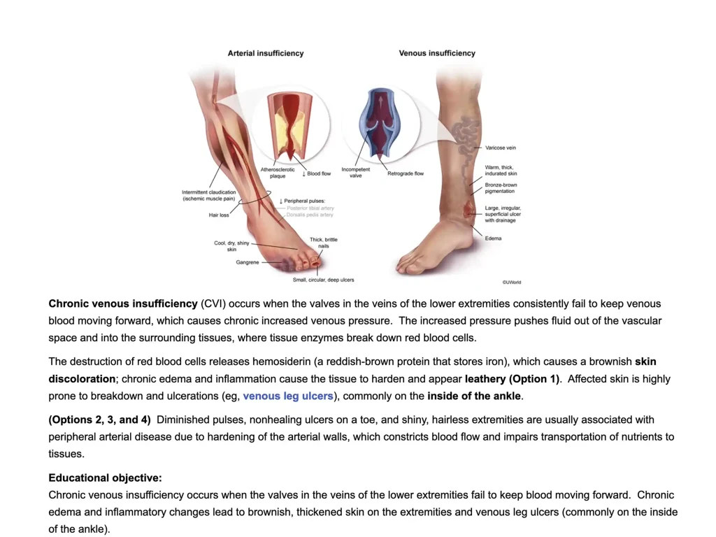 NCLEX-PN practice question explanations for visual learners